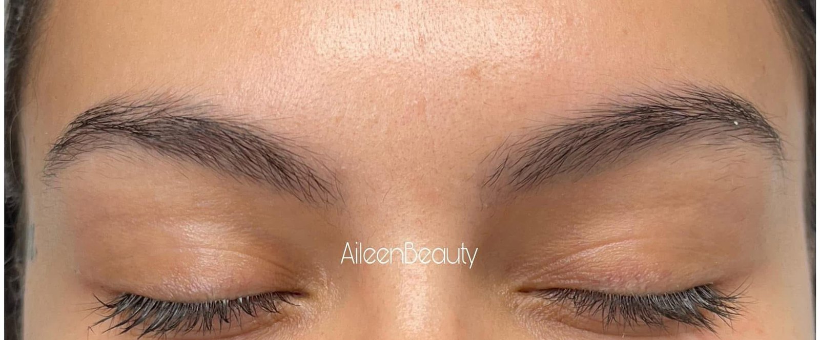 Same client after non-laser eyebrow tattoo removal at Aileen's Beauty: pigment lifted, natural brow hair preserved