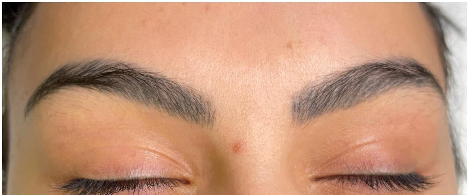 Real client before eyebrow tattoo removal: dense dark microblading pigment